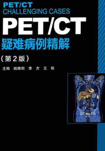 此处应有圣杯战争